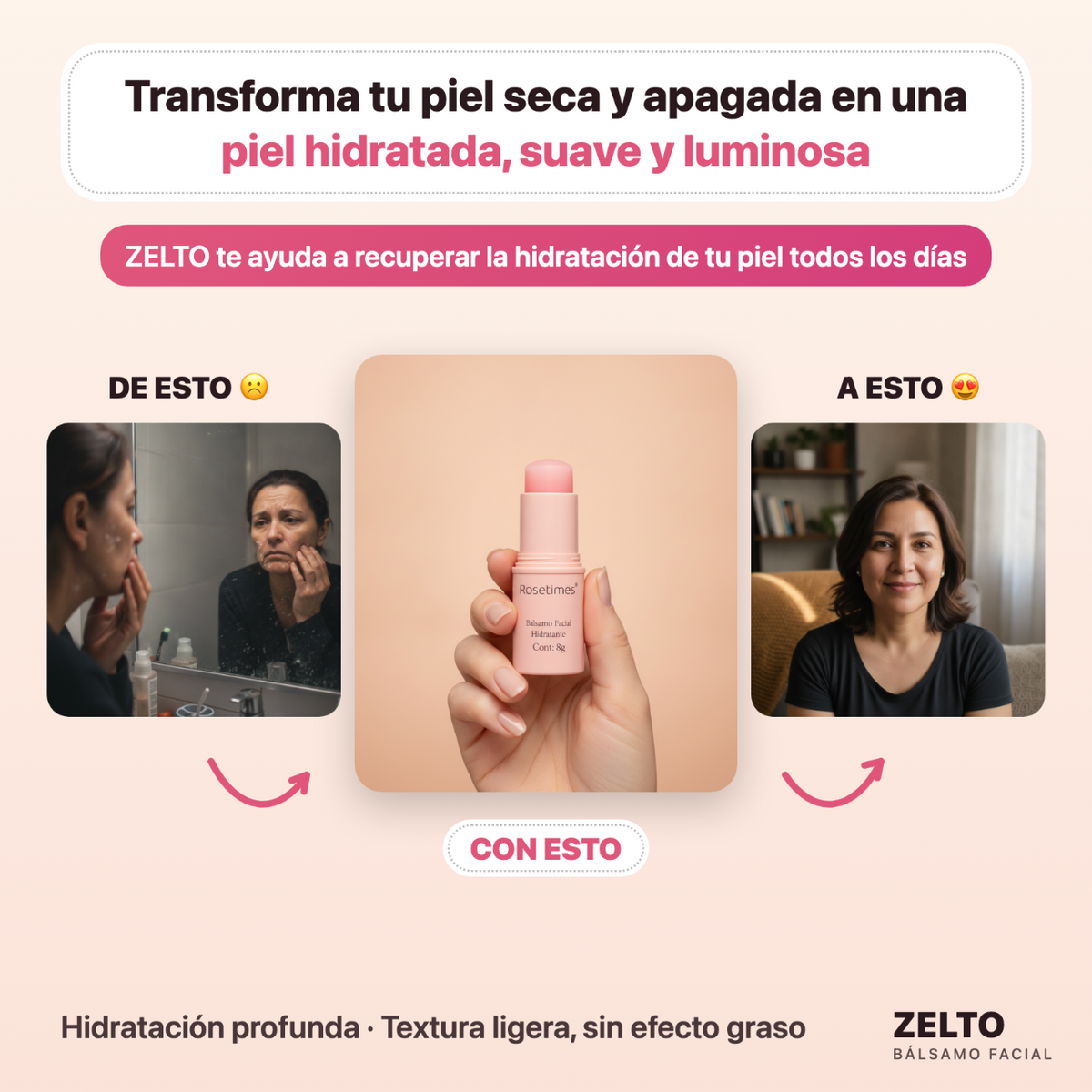 RoseTimes™ —  Compra 1 y lleva 1 de Regalo